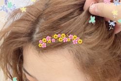 -大麦微针植发全国连锁