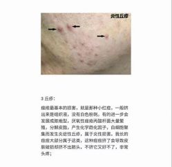 -美肤盾祛痘·问题肌头疗管理中心