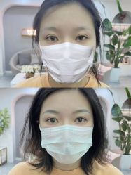 点击看大图 -Verywang半永久纹眉•仪器野生眉