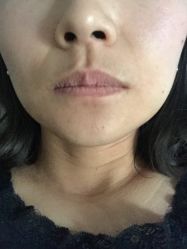 -大华韩艺整形美容医院