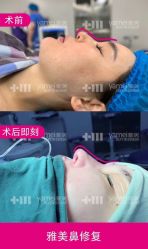 -长沙雅美医疗美容医院