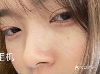 清洁保湿做好!苹果原相机也不带怕!