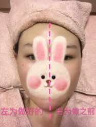 -FACE·日本小颜矫正美容整骨サロン