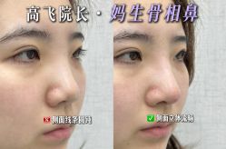 -深圳艺星医疗美容医院