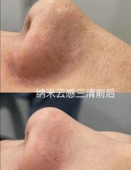 -SKIN79皮肤管理中心