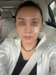 体验后-北京米扬丽格医疗美容·联合丽格鼻整形中心