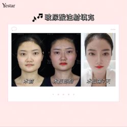 -Yestar艺星医疗美容医院