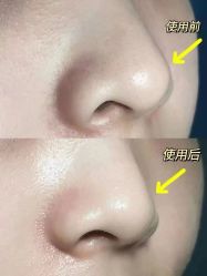 -东英经典SKIN&SPA