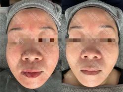 -蒂薇姿问题肌修复中心