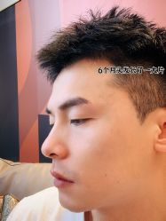 -雍禾植发全国连锁