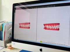 -Dr.Z dental仁康种植矫正中心