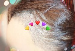 -大麦微针植发全国连锁