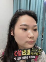 -郡艺医疗美容·微整·眼鼻吸脂