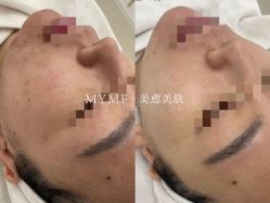 -美愈美肤MEIYU SKIN