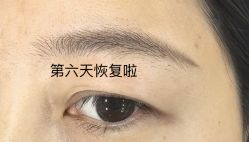-张小野·专业半永久纹眉