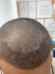 -熙朵美学植发·连锁品牌