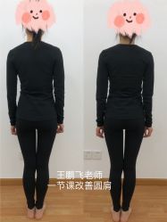 -卓拓普拉提