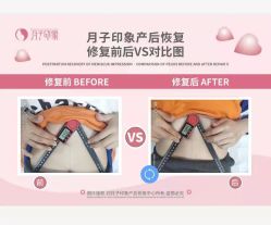 点击看大图 -优美堂产后修护中心