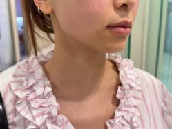 -Yestar艺星整形美容医院