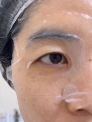 -长沙雅美医疗美容医院