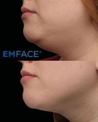 -明潪Selfology升维护理中心