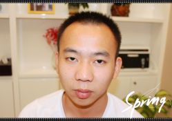 点击看大图 体验后-大麦微针植发全国连锁