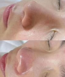 -美愈美肤MEIYU SKIN