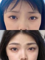 -Doris多里斯半永久纹眉·SMP纹发·发际线