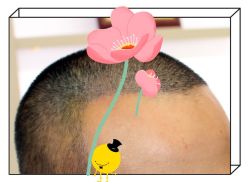 -大麦微针植发全国连锁