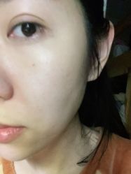 体验后-Dr.U博士医疗美容医院