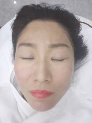 -悟空祛痘·诺奖技术专业店