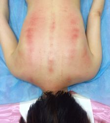 -摩瘦纤体订制减肥