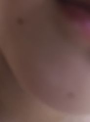 体验前-河南中医药大学第一附属医院·皮肤美容