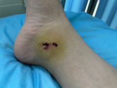 -成都市第一人民医院(南区)