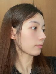 体验后-南宁华美医疗美容医院