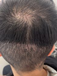 -熙朵美学植发·连锁品牌