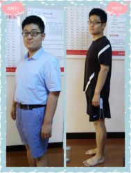 -维纳斯专业减肥