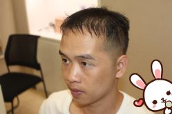 -大麦微针植发丨全国连锁