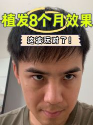 -雍禾植发全国连锁