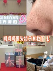 -成都苗方清颜专业祛痘