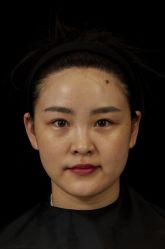 体验前-Dr.U博士医疗美容医院