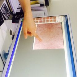 iphone_upload_pic-MedSkinCare科技祛痘肌肤修护中心