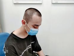 -大麦微针植发全国连锁