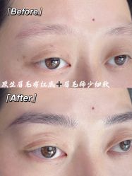 点击看大图 -OnFaer.纹眉半永久无创洗眉