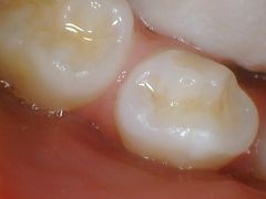 -极橙儿童齿科矫正中心(奥城店)