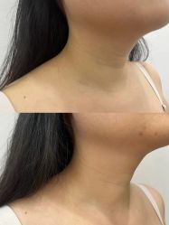 -加减美医美连锁品牌