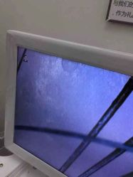 头皮检测-髻尚坊增发补发织发假发定制