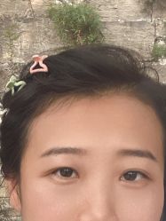 -空军总医院激光整形美容中心