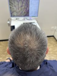 点击看大图 -大麦微针植发全国连锁