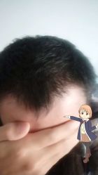 -大麦微针植发丨全国连锁